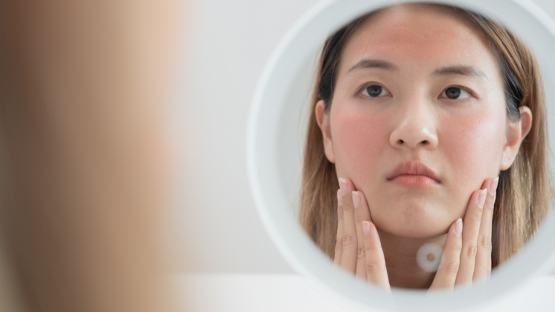 Lưu ý khi sử dụng Alpha Arbutin để tránh kích ứng da