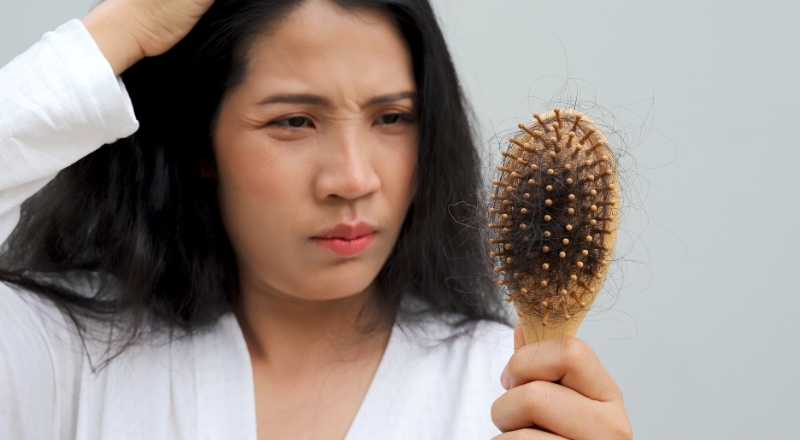 Stress gây rụng tóc: Nguyên nhân, dấu hiệu và cách khắc phục
