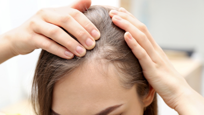 Dấu hiệu nhận biết rụng tóc do stress
