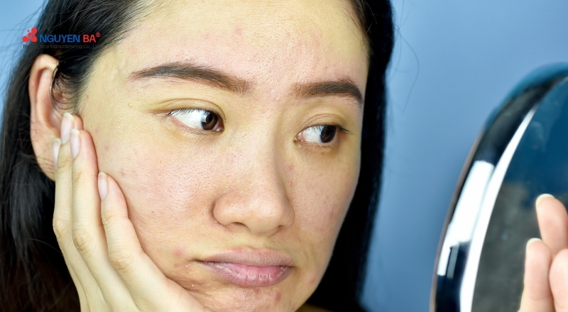 Ánh sáng xanh gây lão hóa, tăng sắc tố và suy yếu hàng rào da