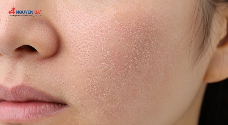 Da thiếu ẩm không chỉ do thời tiết mà còn đến từ cách chăm sóc da
